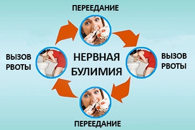 Лечение булимии в Шепси